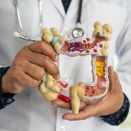 tratamiento-eficiente-coloproctologia-tijuana